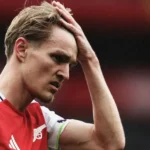 Mikel Arteta Khawatirkan Cedera Odegaard Meski Arsenal Raih Kemenangan